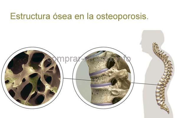 dolor de espalda lado derecho