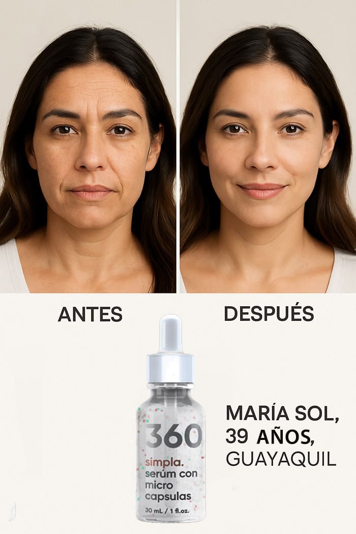 cómo cambió mi piel en 30 días